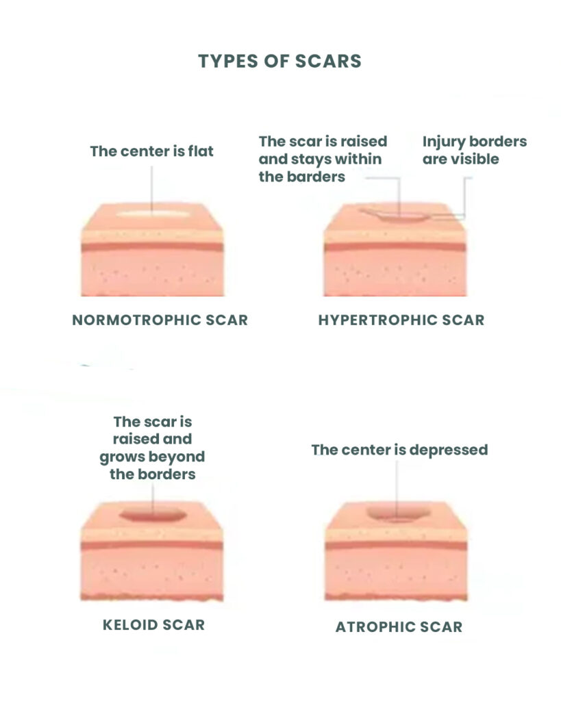 Fade Away Scar and Stretch Mark Cream