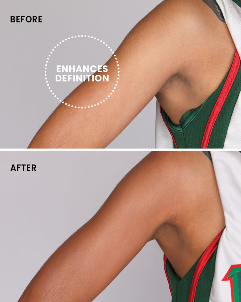 Enhance Definition on Arms