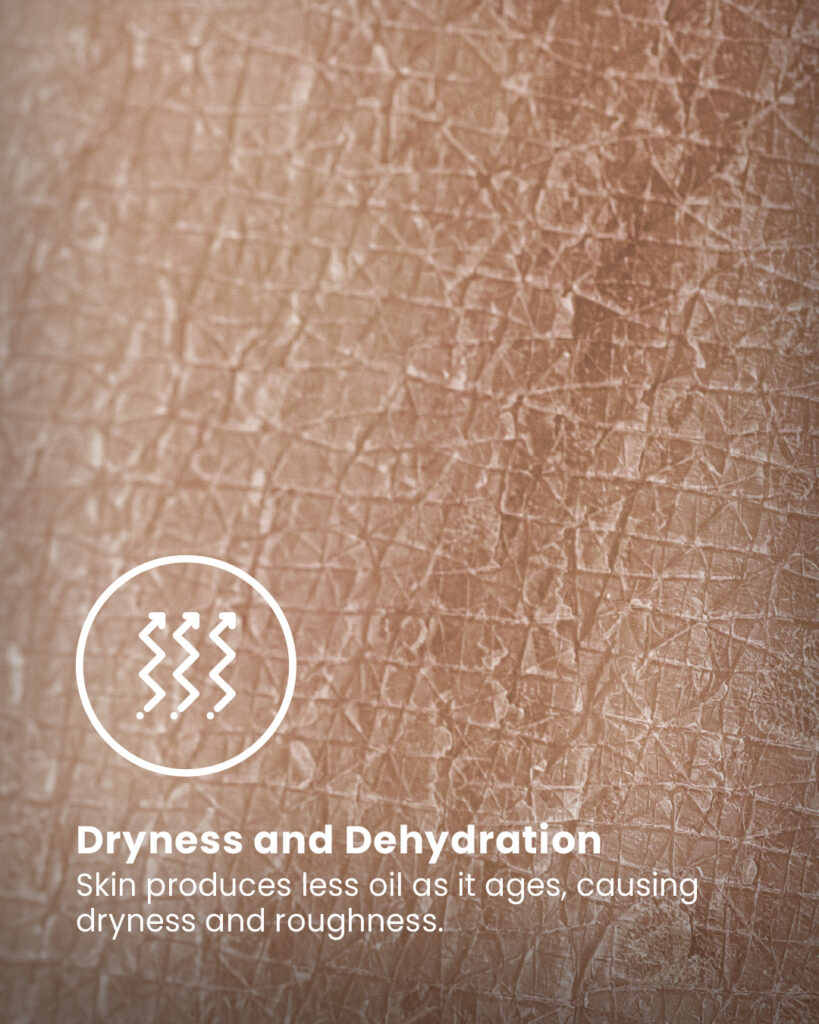 Dryness and Dehydration
